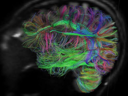 A Diffusion Spectrum MRI (DSI) of the human brain obtained with the MGH-UCLA Human ?Connectom? Scanner. The fiber tracks are color-coded by direction: red=left-right, green  =anterior-posterior, blue=through brain stem. (Credit: National Institutes of Biomedical Imaging and Bioengineering and National Institutes of Health)